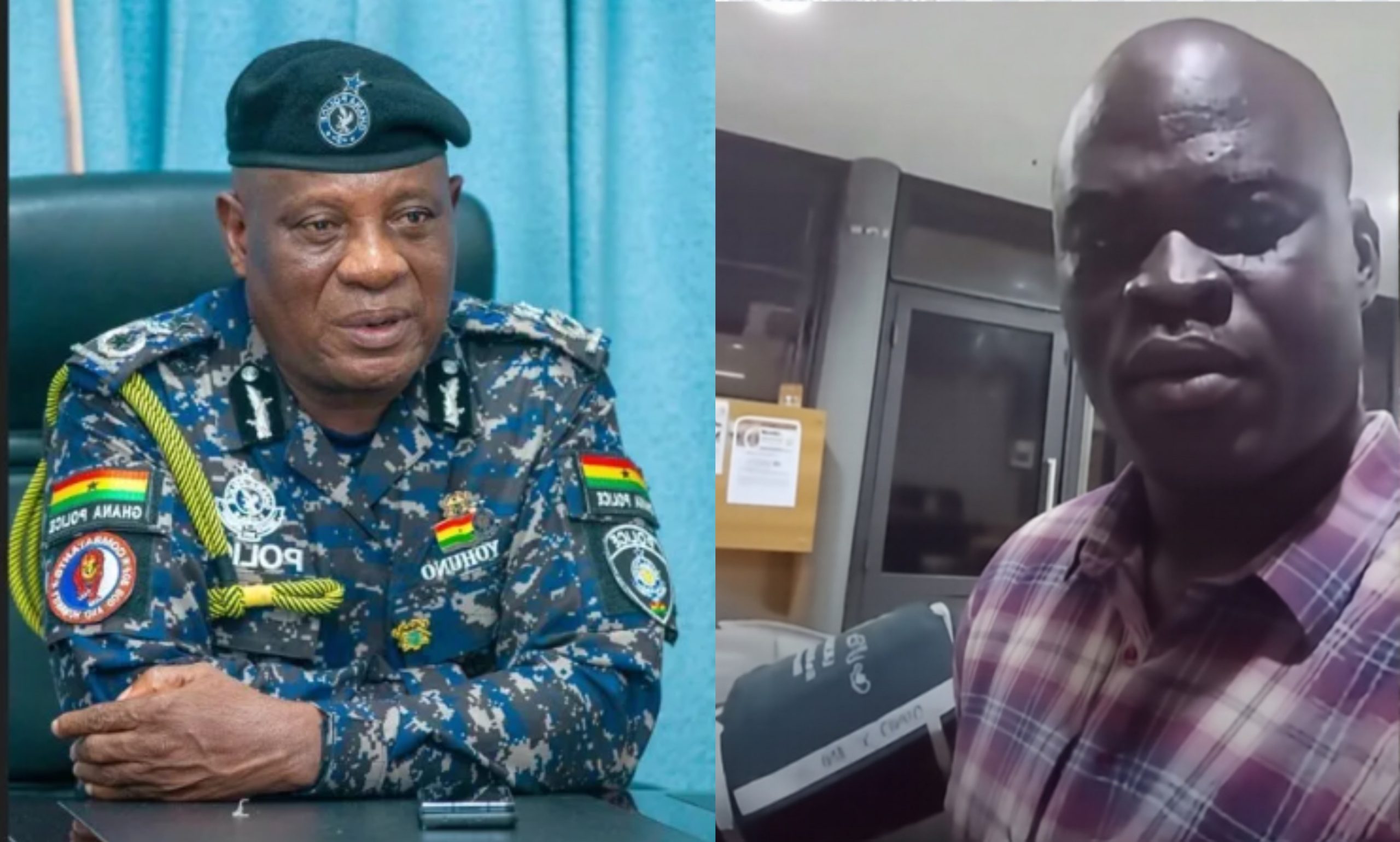 Inspector General of Police (IGP), Christian Tetteh Yohuno, left, and Police officer Nicholas Oheneampong Kissi receiving hospital treatment after alleged assault